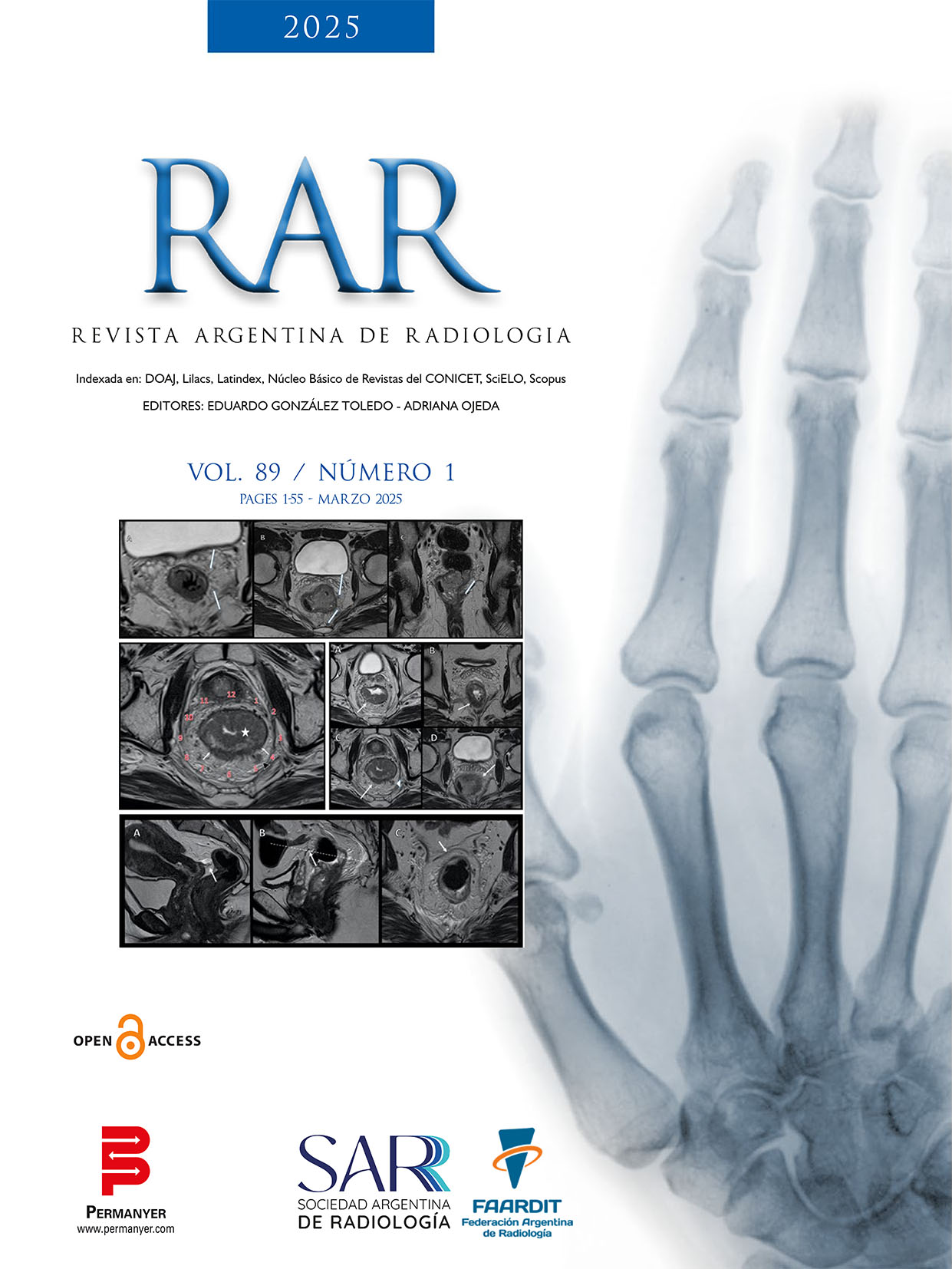 Vol.89 Num.1